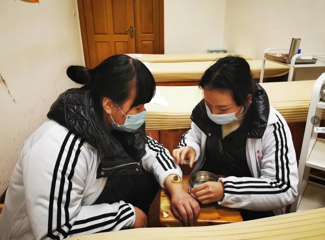 重慶康復理療培訓：怎樣選擇適合的艾灸工具？